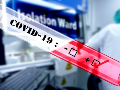 &Kappa;&omicron;&rho;&omicron;&nu;&omicron;ϊό&sigmaf;: &Tau;&alpha; &nu;έ&alpha; &kappa;&rho;&omicron;ύ&sigma;&mu;&alpha;&tau;&alpha; &sigma;&tau;&eta;&nu; &Alpha;&rho;&gamma;&omicron;&lambda;ί&delta;&alpha;