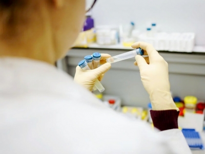 &Kappa;&omicron;&rho;&omicron;&nu;&omicron;ϊό&sigmaf;: &Tau;ό&sigma;&alpha; ή&tau;&alpha;&nu; &tau;&alpha; &theta;&epsilon;&tau;&iota;&kappa;ά rapid test &sigma;&epsilon; Ά&gamma;&iota;&omicron; &Delta;&eta;&mu;ή&tau;&rho;&iota;&omicron;, Ά&rho;&gamma;&omicron;&sigmaf; &kappa;&alpha;&iota; &Nu;&alpha;ύ&pi;&lambda;&iota;&omicron;